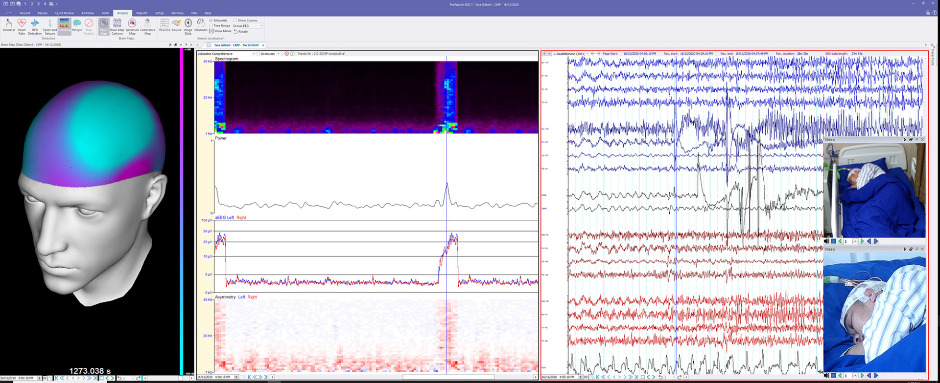 presentation software eeg